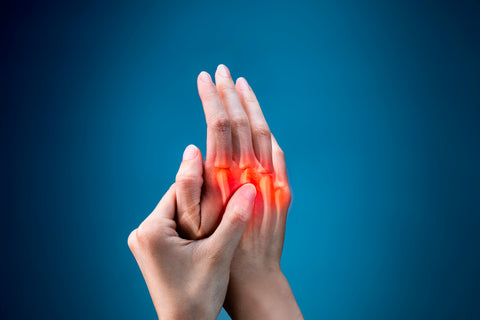 Rheumatoid arthritis hands