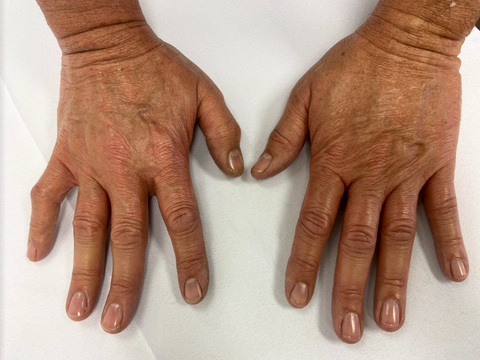 Post paraffin wax treatment for mens hands