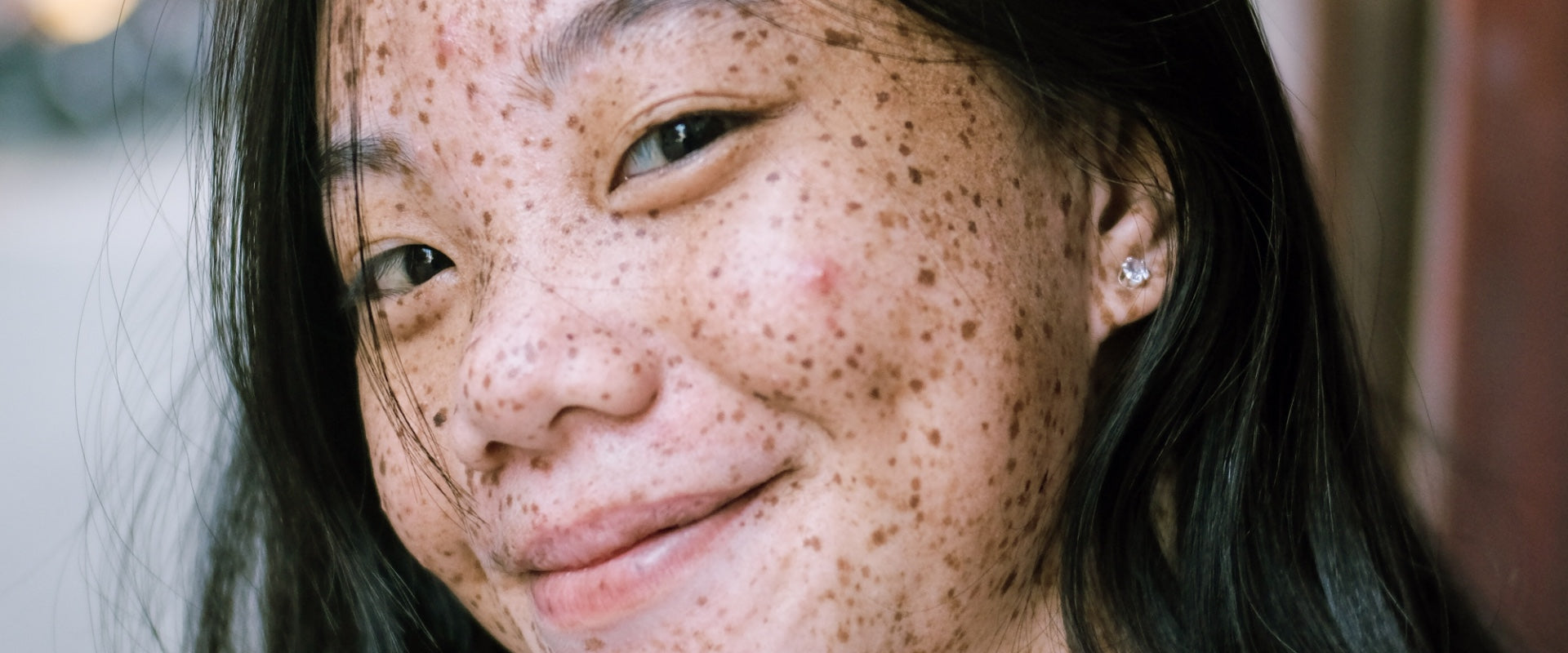 How To Treat Oily Skin Gabi Skin™