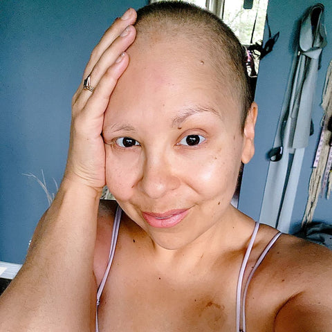 Image of founder going through chemo for breast cancer