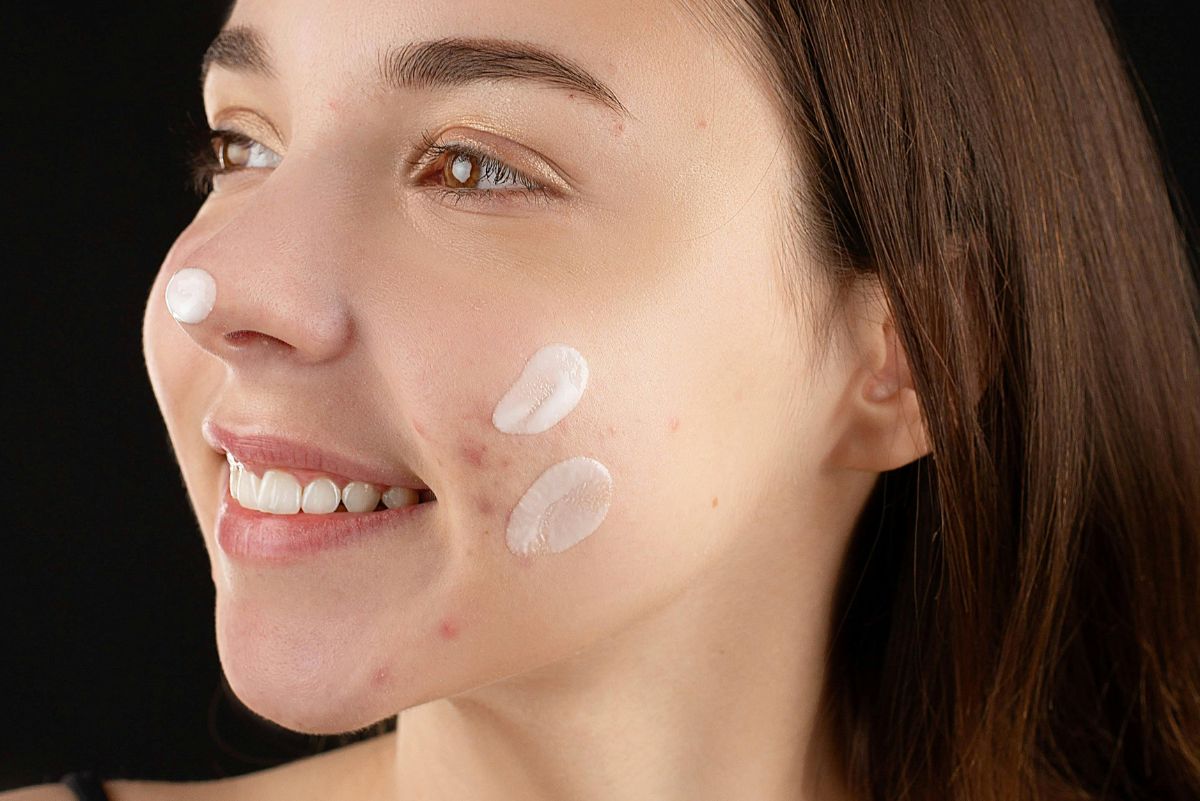 Close up of woman with blemish cream on her face