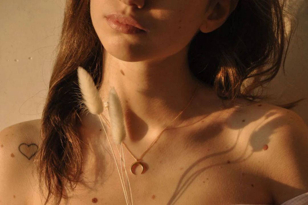 woman with moles on chest