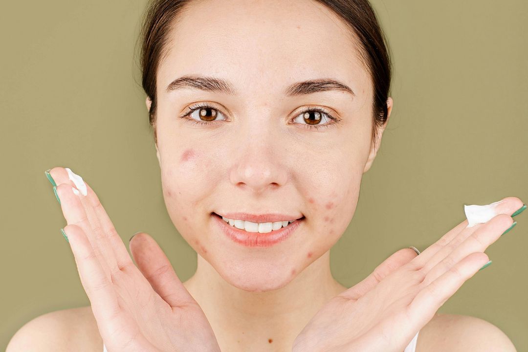 close up of girl with hands beside her face ready to apply sunscreen