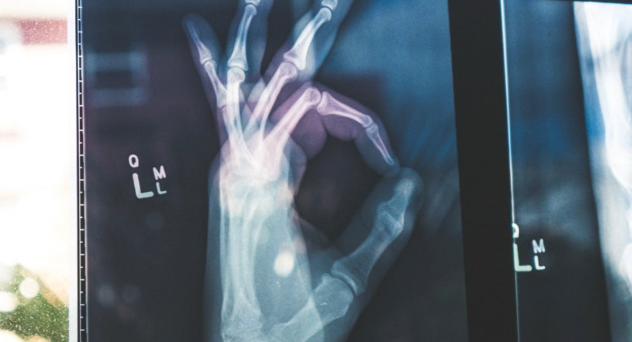 xray image of a person's hand doing ok gesture