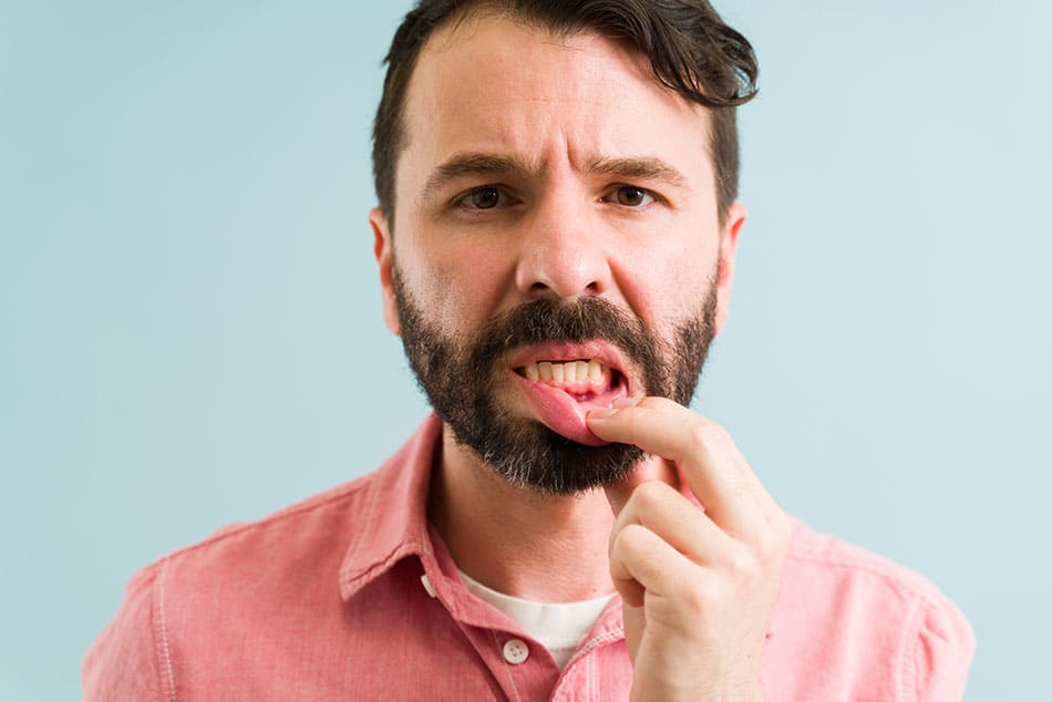 Man pulling down bottom lip to reveal a darker red inflamed gum, stood in front of a light blue gradient background.