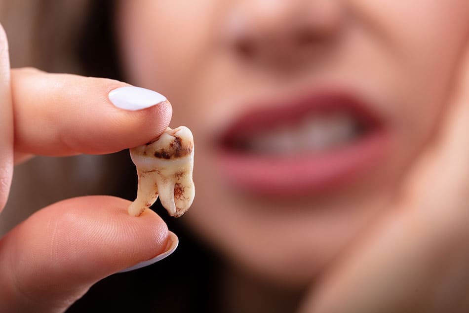 Woman with a disgusted look on her face holding up a decayed tooth close to the camera.