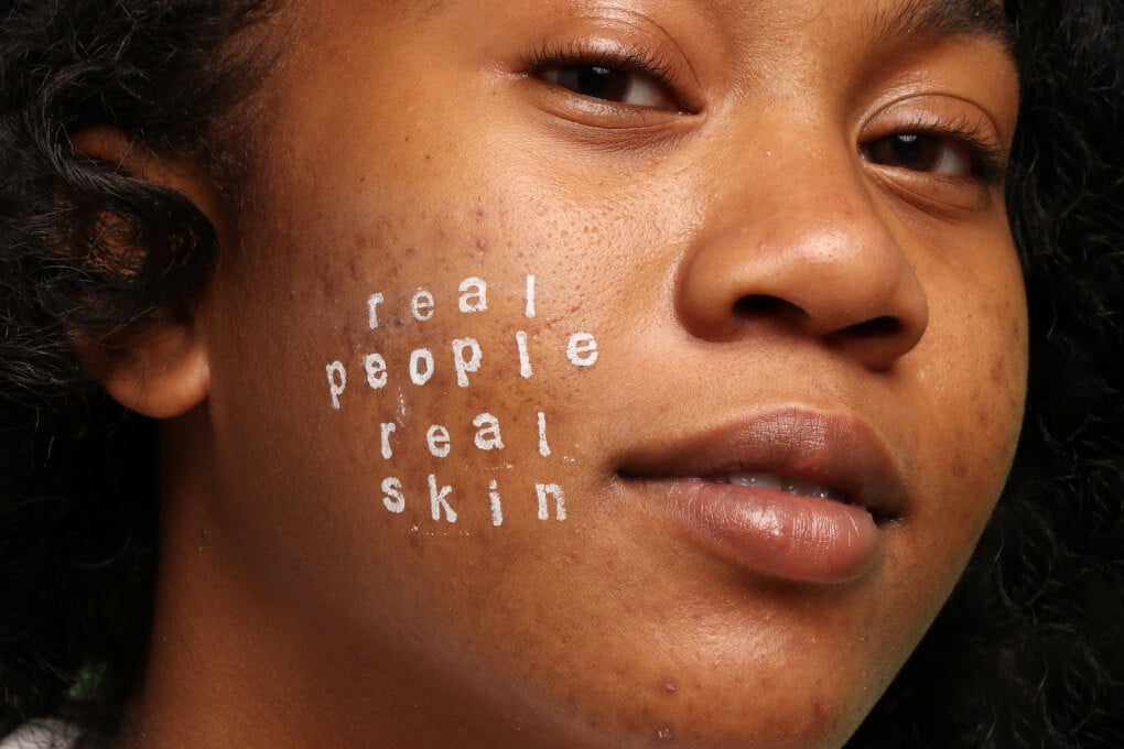 model with real skin real people written on cheek