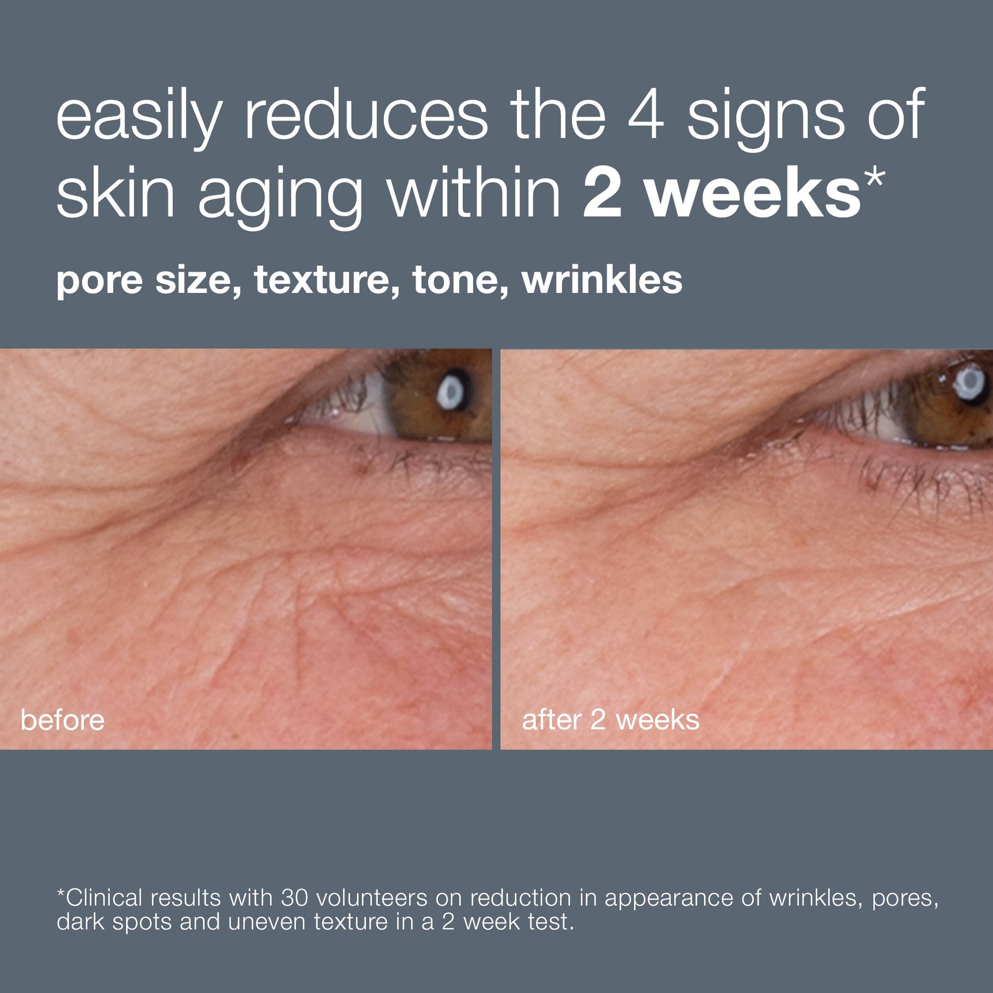 Dynamic Skin Retinol Serum, Anti-Aging Wrinkle Serum |