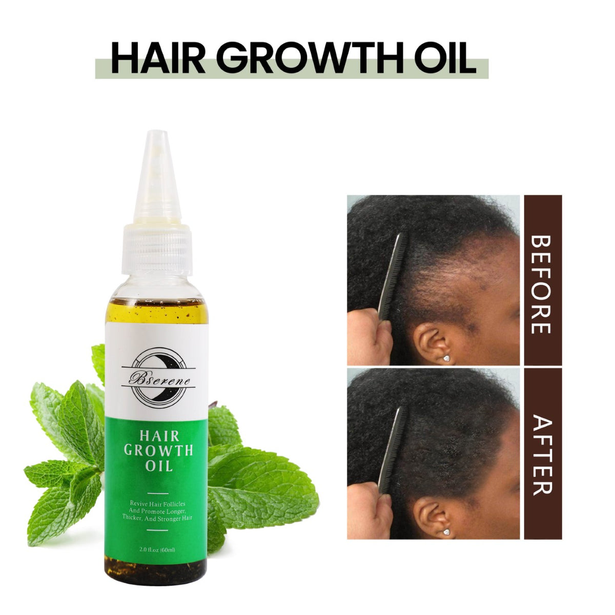 Bserene Hair Growth Oil Regrowth Kit