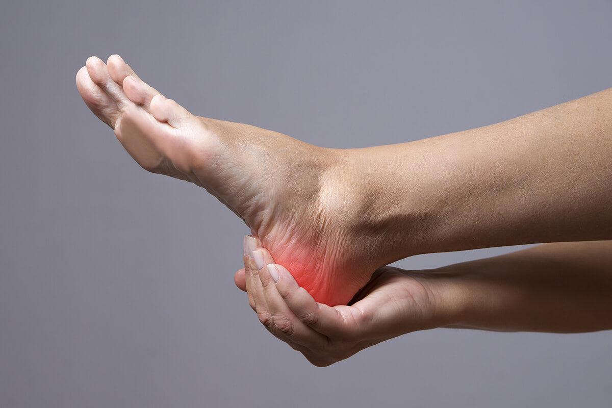 Plantar Fasciitis