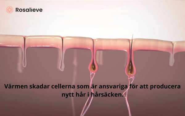 Så fungerar IPL ljuset