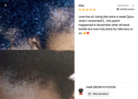 customer review of traction alopeica