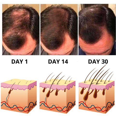 HairMed™ Regrowth šampoonibaar