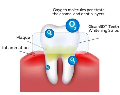 Gleam3D™ Teeth Whitening Strips