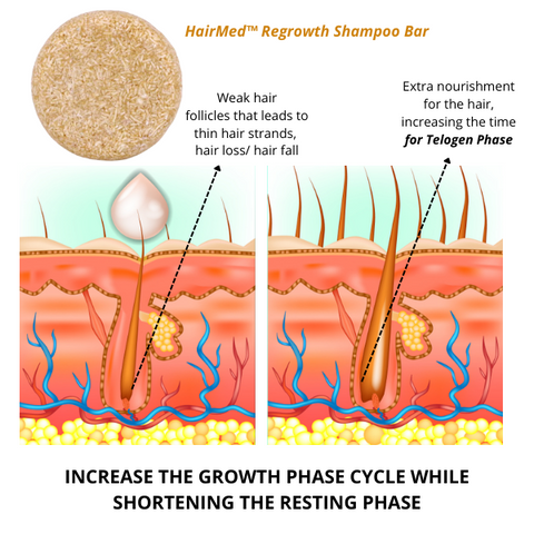 HairMed™ Regrowth Shampoo Bar