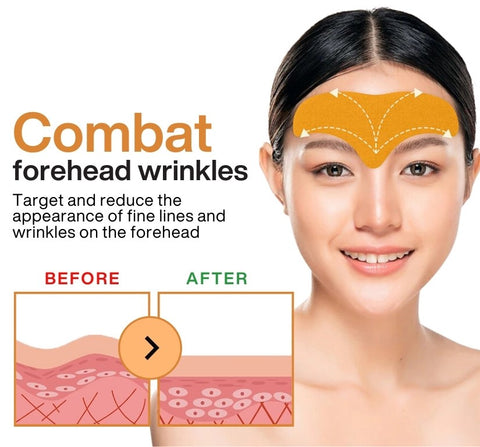 DermaBliss™ Forehead Wrinkle Patch