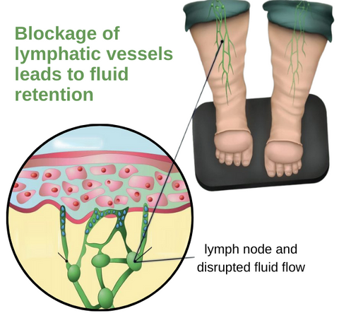 SlimTech™ Lymph-Drainage Leg Massager