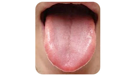 HealPlus™ Tongue Repair Spray