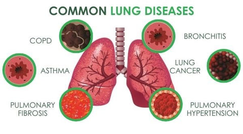 Respira™ Lung Care Spray