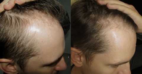 Шампунь для восстановления волос HairMed™