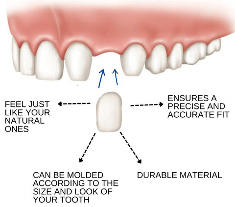 SmileFix™ Thermal Forming False Teeth 