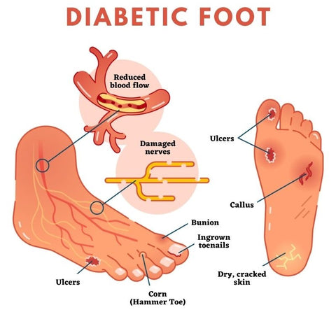 MedTech™ Diabetic Socks 