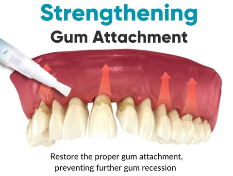 DentiZen™ Gum Therapy Gel