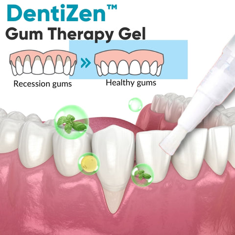 DentiZen™ Gum Therapy Gel