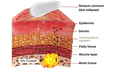 GoutAid™ Inflammatory Pain Cream