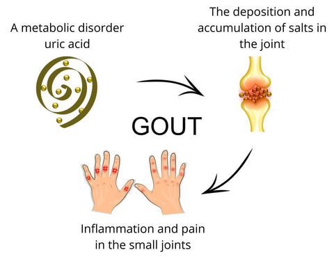 GoutAid™ Inflammatory Pain Cream