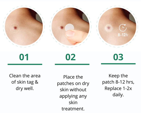 SkinPro™ Skin Tag Remover Patch