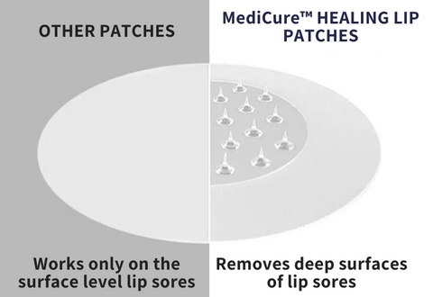 MediCure™ Healing Lip Patches