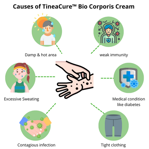 TineaCure™ Bio Corporis Cream