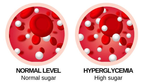 Mericle™ Sugar Control Acupressure Neck Device