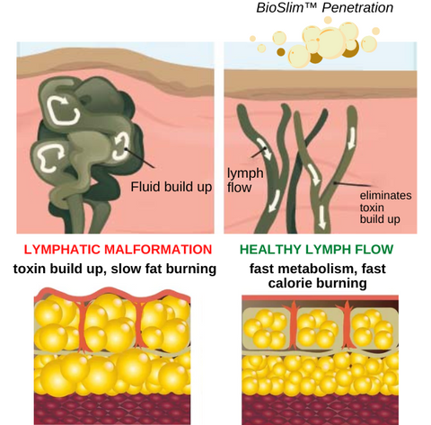 BioSlim™ Lymphatic Drainage Shower Gel