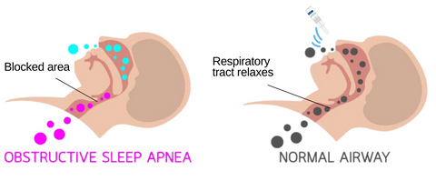 SleepSolution™ Nasal Mist