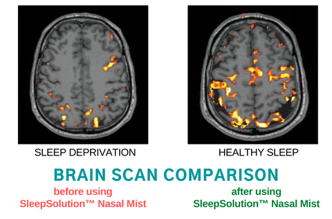 SleepSolution™ Nasal Mist