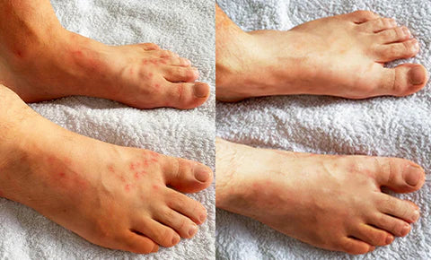 AEXZR® ItchBreak Sea Salt Soak