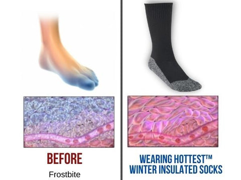 HOTTEST™ Winter Insulated Socks