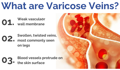 VenaCure™ Varicose Vein Cream
