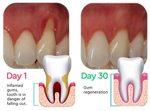 GumZen™ Gum Repair Strips