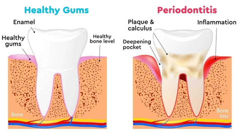 GumZen™ Gum Repair Strips