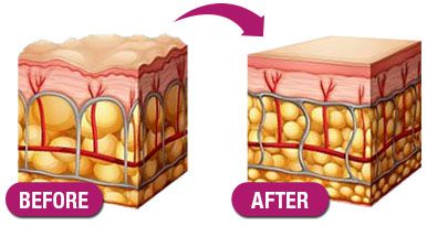 PuriMe Korean Collagen Firming Mask