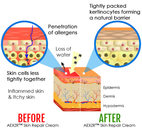 AEXZR™ Skin Repair Cream
