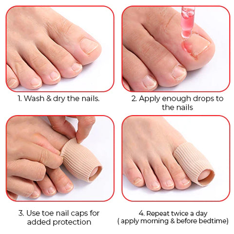 Nailcare™ Ingrown Toe Nail Drops 