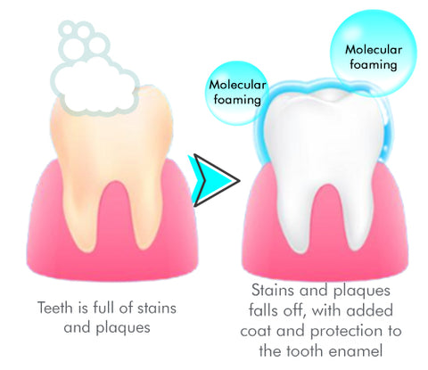 DentalCare™ Whitening Mousse Toothpaste
