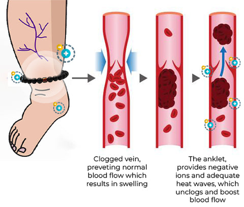 Zunis™ Thermotherapy Detox Anklet