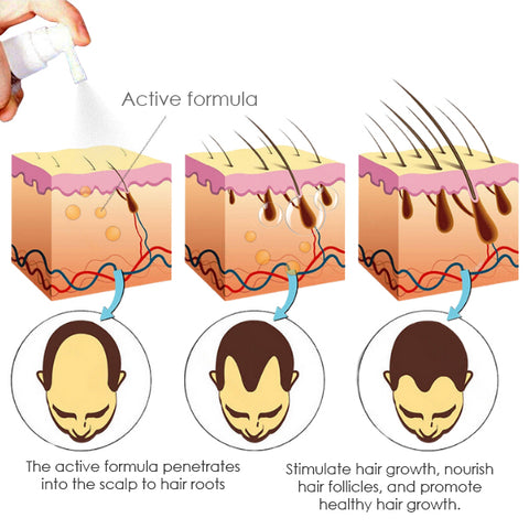AEXZR™ Hair Regrowth Ginger Spray