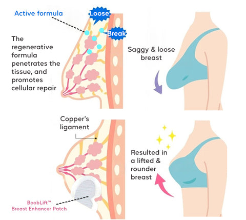 BoobLift™ Breast Enhancer Patch