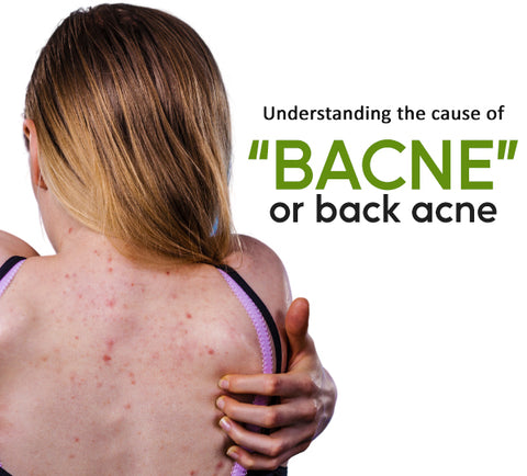 ClearSkin™ Bacne Treatment Spray